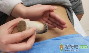 体热的人可以艾灸吗