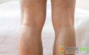 老寒腿是什么症状能不能治好