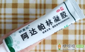 阿达帕林凝胶治疗闭口是直接脱落还是爆痘