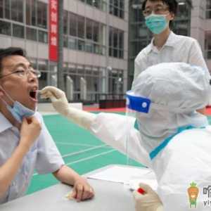 核酸检测只能周一到周五做吗