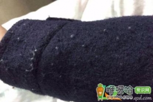 衣服爱起球是怎么回事