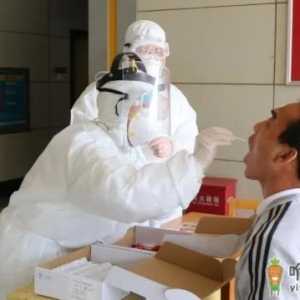 做核酸检测需要医生开单子吗
