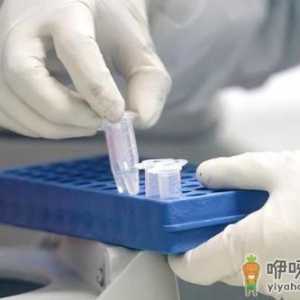 核酸检测混检和单检哪个出结果快