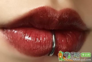 嘴角裂口一直不好怎么回事