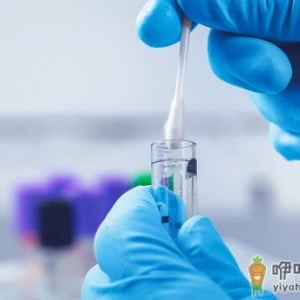 核酸检测是不是只有一项