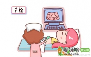 产检能往后推迟几天去么