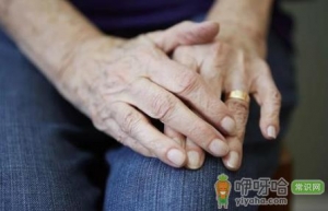 强直性脊柱炎国家免费治疗是真的吗