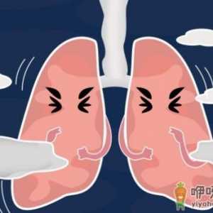 干咳和湿咳哪个严重 除了感冒会咳嗽还有什么会咳嗽