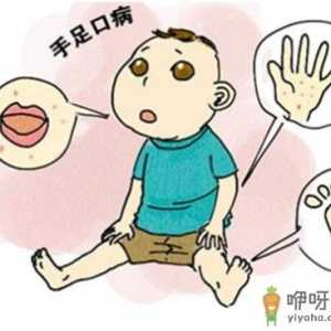 手足口疫苗打好还是不打好 接种手足口疫苗可以管多久