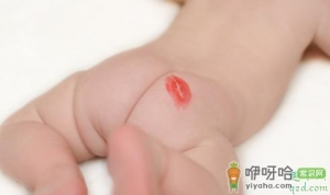 宝宝红屁股大概什么时候会没有 宝宝屁屁红怎么办快速解决