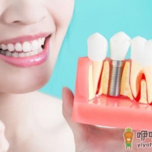 种一口牙相当于买辆宝马 种植牙的有关护理事项