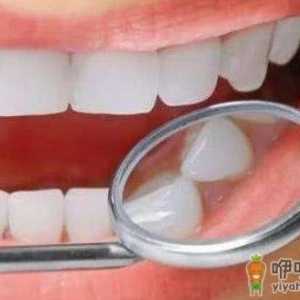 导致牙齿发黄的5大原因 搭配不同的食物进行美白牙齿