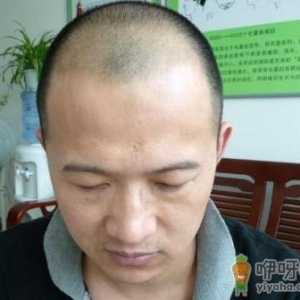你不知道的事 身体这些部位越丑陋越健康