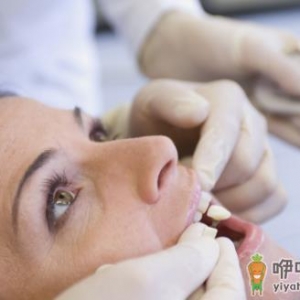 洗牙问题大揭秘 全方位告诉你洗牙好与坏