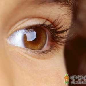 从眼睛看健康：眼睛泄露你的健康密码