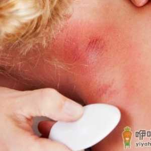 刮痧能治疗的疾病揭秘 刮后要注意保暖防寒