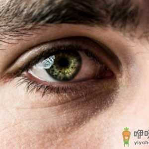 眼屎多是你的眼睛生病了 引起眼屎原因复杂