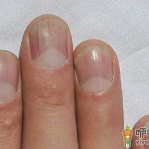 如何从指甲形状看个性和疾病