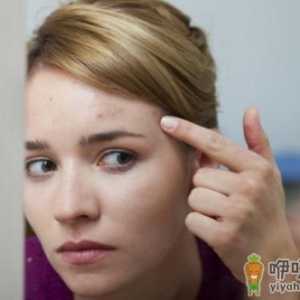 不同部位长痘原因不同 视而不见会加重你的问题