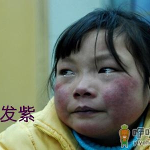 嘴唇颜色反映身体健康状况