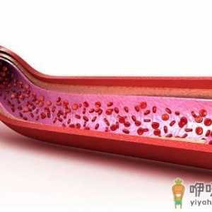 血管是人的生命的通道 养护血管的饮食调理