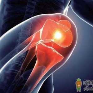 膝骨关节炎影响生活质量和运动能力 骨关节炎的预防