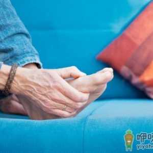 碰上这些情况痛风也有假的 教你辨别真假痛风