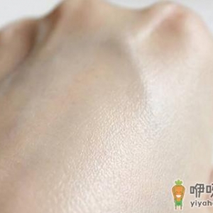 神经性皮炎的症状及病因有哪些