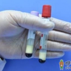 老人血液变牛奶白 究竟是怎么回事
