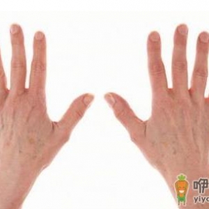 过敏性皮炎湿疹该怎么办