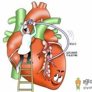冠心病能不能治好呢