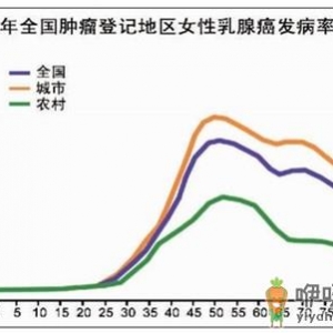 尿样检测可查乳腺癌