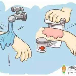 阻止继续烧伤只要18秒