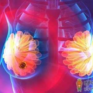 乳腺结节对女性危害大 乳腺结节形成的原因及预防