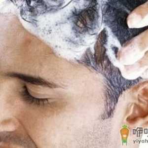 男人怎么洗头才能防止头屑多