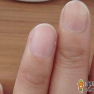男人肾虚有哪些表现 看手指辨疾病
