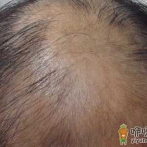 男性养生必知：男人性衰老7大迹象