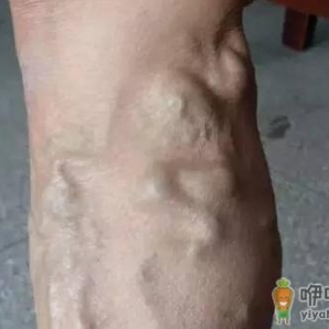 男人当心惹四大女人病