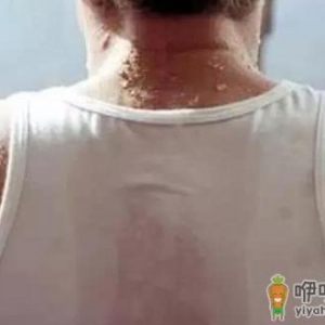 常出汗是病？老人出汗异常的症状
