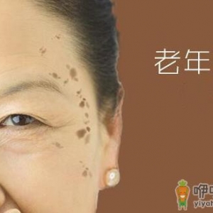 老人怎样饮食能减少老人斑
