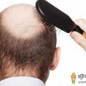 对抗中年男性脱发的食谱