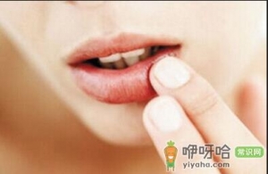 烂嘴角怎么办?如何调理?