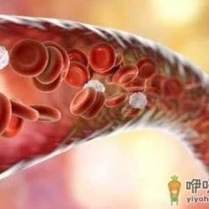 醋红酒鱼油是否能软化血管 软化血管不能吃的食品