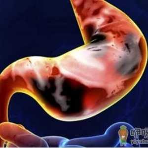 胃癌活动期的饮食禁忌 晚期胃癌患者的护理大全