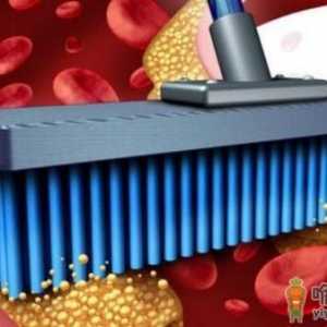 蔬菜清理血管垃圾 食疗调理效果最佳
