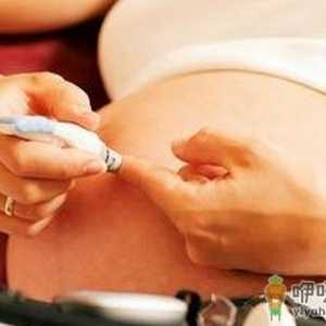 孕妇如何补铁？多吃动物内脏