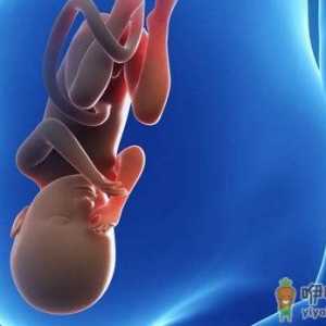 什么是妊娠中毒症？妊娠中毒的原因