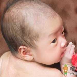 新生儿黄疸的预防护理