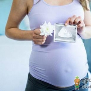 龙凤胎是同卵还是异卵？