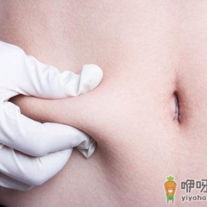 360环形抽脂 造就完美身材